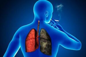 Неделя профилактики рака легких